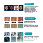 Skin Analyzer-02 - 图片 5